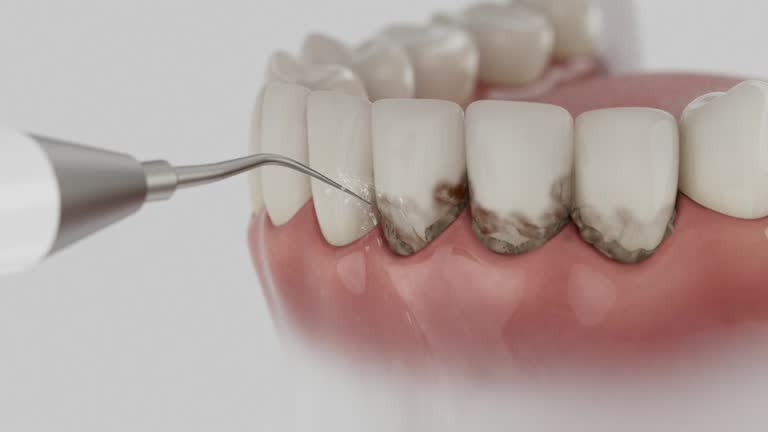 Reliable Dental Implants contractor in Trappe, MD by Smile Center Dentistry